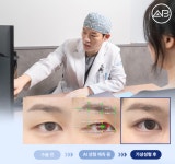 에이비성형외과, 인공지능AI 기반 가상 눈성형 도입… 실제 케이스 데이터로 정밀 예측