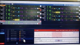 대웅 씽크가 심정지 위기 막았다…광주한국병원, 조기 대응