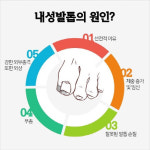 내성발톱 및 문제성 손발톱 전문케어 홀드핀칭 전문적인 관리로 인기