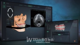 라온메디 얼라인스튜디오, 미국 FDA로부터 의료기기 승인받아… 구독 서비스 등 지원 빙침