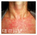일본 풍진 유행, 해외여행 시 주의