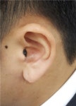 조은소리보청기 이야기(2) 나에게도 보청기가 필요한가?