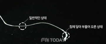 아미덴, 혁신적인 스펀지 치실 홍콩 시장에 수술