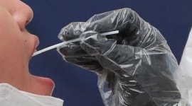 대구 코로나, 달성군 유가읍 유황원스파 찾았다면…무증상도 검사
