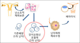 시험관시술 성공률 획기적으로 끌어 올리나?