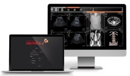 유비케어, 의료영상 통합관리 솔루션 UBPACS-Z 출시