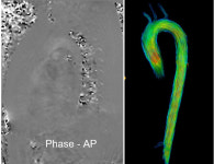 케이메디재단, 4차원 혈액흐름 영상기술 기업에 이전