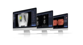 의료 AI 솔루션 플랫폼 선두주자로 자리매김