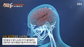 소뇌위축증 장애란?..보디빌더 오영복씨의 인간승리 뭉클