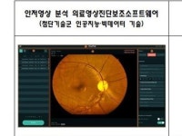 식약처, 혁신의료기기 2개 제품 최초 지정