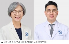 건선 ‘중증도’ 이제 육안 아닌 객관적 수치로 확인