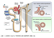 당뇨병 - SGLT-2억제제 ③