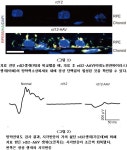 세계 최초 레버선천흑암시 생쥐 유전자 완전 교정 성공…선천망막질환 교정 가능성 확인