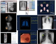 2019년 의료기기 8,269개 허가…인공지능(AI) 활용 늘고 실버제품 확대