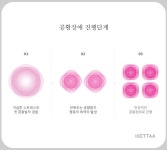 [칼럼] 공황장애, 만성화 되기 전 전문적 상담 받아야