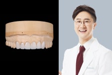 [칼럼]올세라믹 심미보철치료 특징과 주의사항