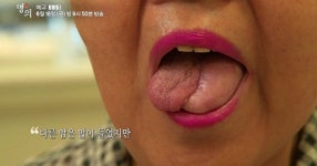 팝핀현준(남현준) 아버지 설암으로 별세, 초기증상 무엇? 이 나이  잘 걸린다