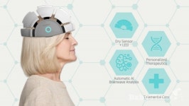 아이메디신, 뇌파AI 알츠하이머 조기 감별 OK