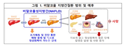비알코올성지방간 NAFLD 그대로 방치하면, 10년 내 심혈관질환 4~8배 증가  