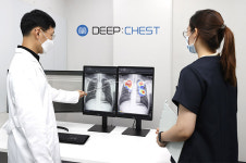 파주시보건소, 딥노이드 AI X-ray 영상판독시스템 구축