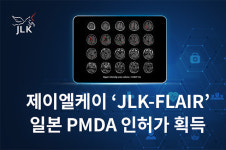 제이엘케이, AI 뇌졸중 진단 솔루션 ‘JLK-FLAIR’ 일본 PMDA 인허가 획득