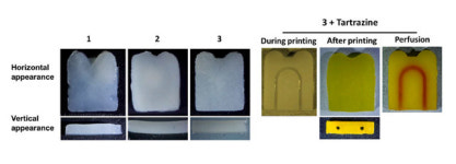 한림대춘천성심병원 박찬흠 교수팀, 3D프린팅용 치아 조직 형성 유도 바이오잉크 개발