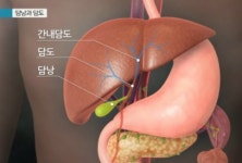 이왕표 담도암, 건강에 좋은 음식 오히려 毒 가능성