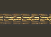 시지메드텍, 몸에서 녹는 혈관스텐트 개발 추진