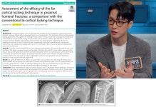 유재성 위라이브병원 대표원장, 신 골절 고정술 입증… “SCI 국제학술지 연구 성과 발표”