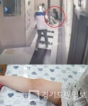 논란 용인 개 물림 사건, 핫이슈 등극한 충격의 사진 한 장?... 네티즌 분노 유발했다
