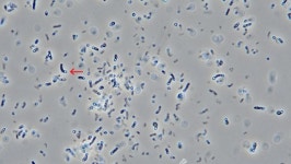 4년 간 싸웠던 보톡스 균주전쟁서 승기 잡은 메디톡스… 최종 결과 향배는?