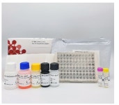SG메디칼, 코로나19 중화항체 진단 검사키트 수출 본격화