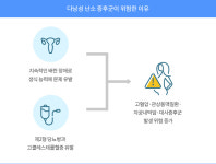 월경 불순·다모증·난임 유발… 임신 계획 따라  맞춤 치료 권장