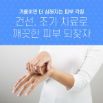 겨울이면 더 심해지는 피부 각질... 건선, 조기 치료로 깨끗한 피부 되찾자!