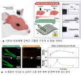 뇌심부 신경세포 신호 측정할 수 있는 길 열렸다