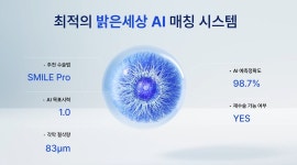 서울·부산 밝은세상안과, AI 기술로 환자별 적합한 시력교정술 제안