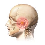 [칼럼] 턱관절 장애 연령별 발생 원인