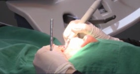 순창군, 어르신 임플란트비 1백만 원 지원