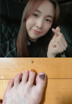 간미연, 부상으로 발톱 빠져…아유미 좋아요는 안 눌러