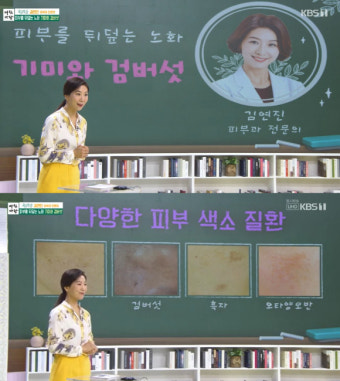 '아침마당' 기미 관리 
