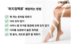 하지정맥류 예방법