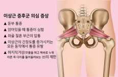 허리디스크 오인 쉬운 이상근증후군이란?