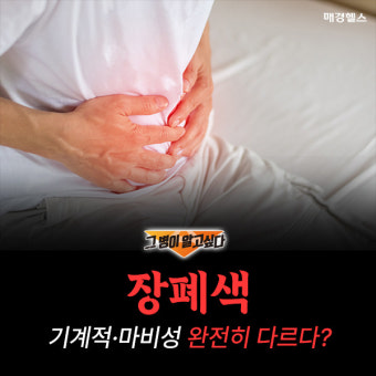 장폐색, '기계적'·'마비성' 완전히 다르다?