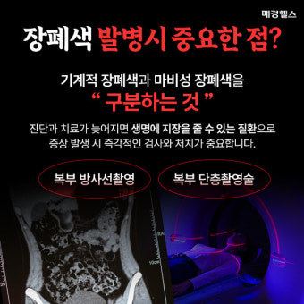 장폐색, '기계적'·'마비성' 완전히 다르다?