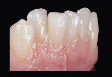 [핫프러덕트] 하이덴탈코리아 MULTISTRATUM® FLEXIBLE