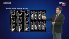 오스템, 라이브 ‘덴올 수요세미나’ 인기