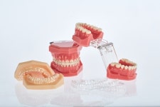 [특집] 디오 DIO Ortho navi. Clear Aligner