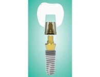 클릭 한번으로 치과 크라운 체결!