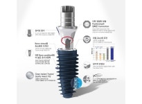 [핫프러덕트] 메가젠임플란트 BLUEDIAMOND IMPLANT