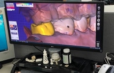 [연중기획] 내치과 ‘디지털 치과’ 만들기⑫ - 디지털 플랫폼 ‘큐브세븐틴’을 만나다